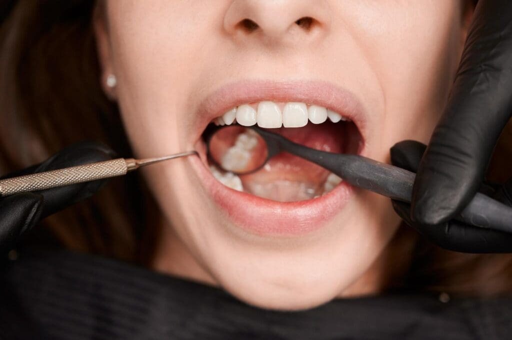 How do you tell if you have a cavity?