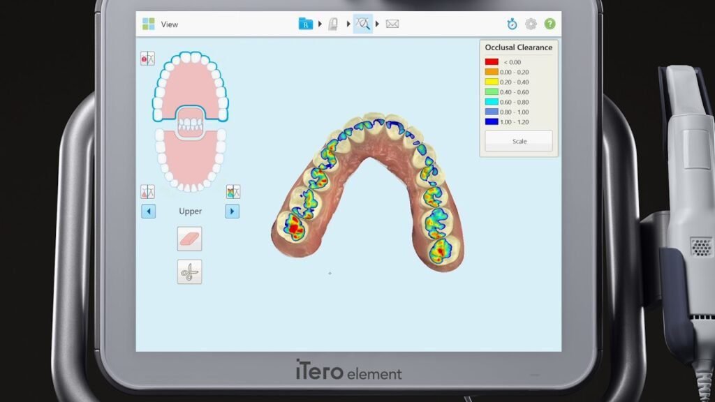 Dentist Near Me – Toothcrew Family Dental Uses Digital impressions-Latest Dental Technology for a More Comfortable Visit