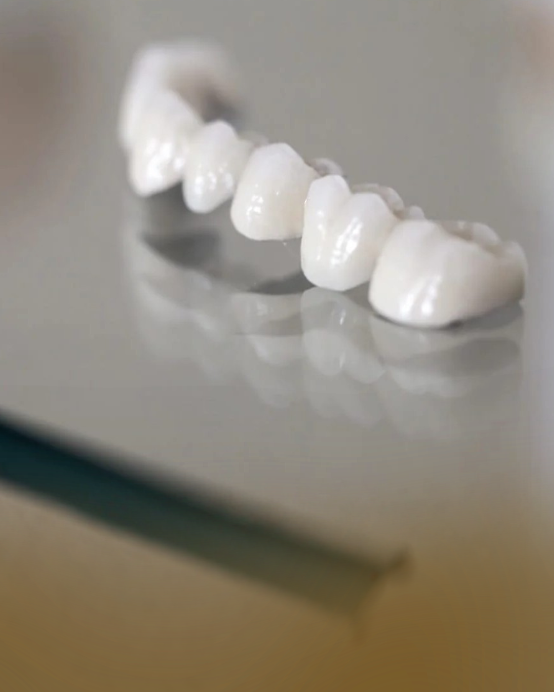 Perfect smile Dental Bridges